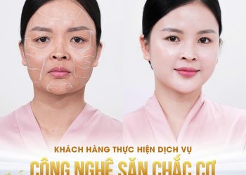 “Đảo ngược lão hoá” với Công nghệ săn chắc cơ, trẻ hoá da toàn diện tại Phòng khám HYE ONG